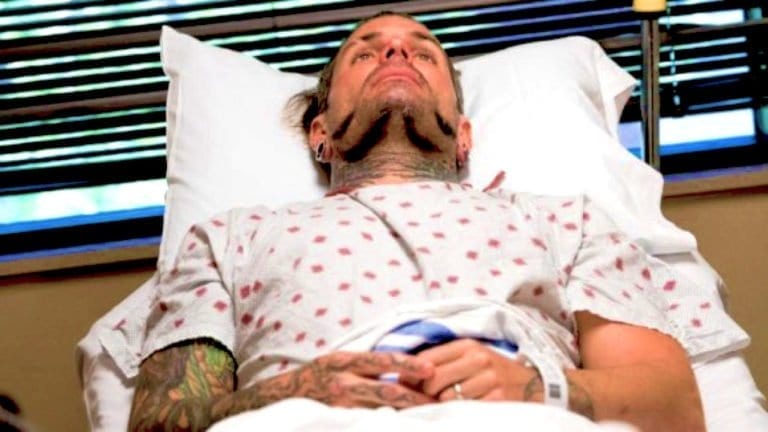 Jeff Hardy Injured at Live Event over the Weekend